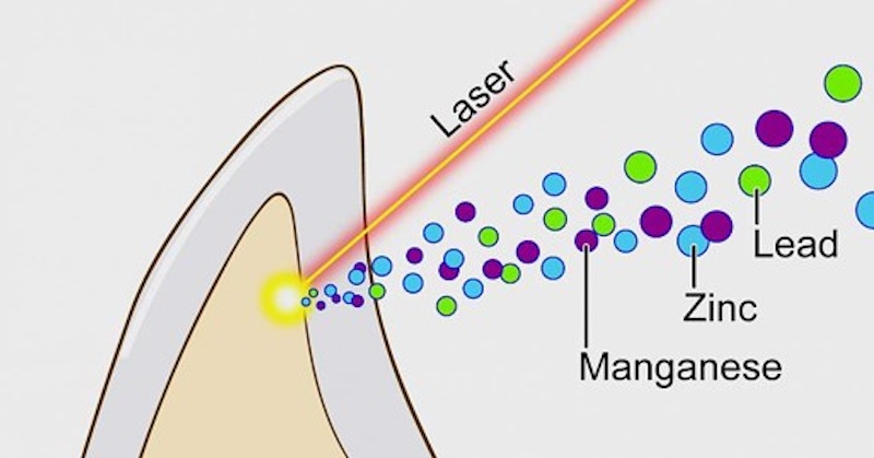 Vedci pomocou laserov zistili, že zuby autistických detí majú vysokú hladinu ťažkých kovov