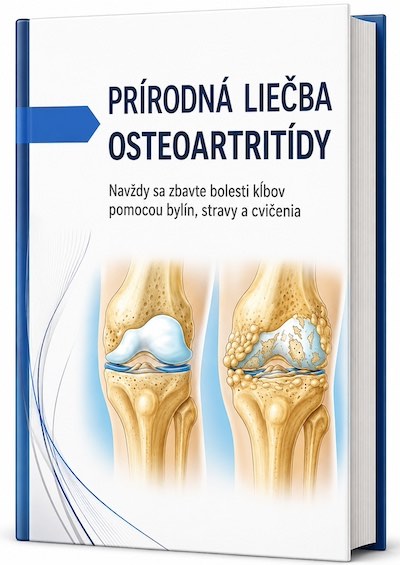 e-Kniha: Prírodná liečba osteoartritídy e-Kniha: Prírodná liečba osteoartritídy